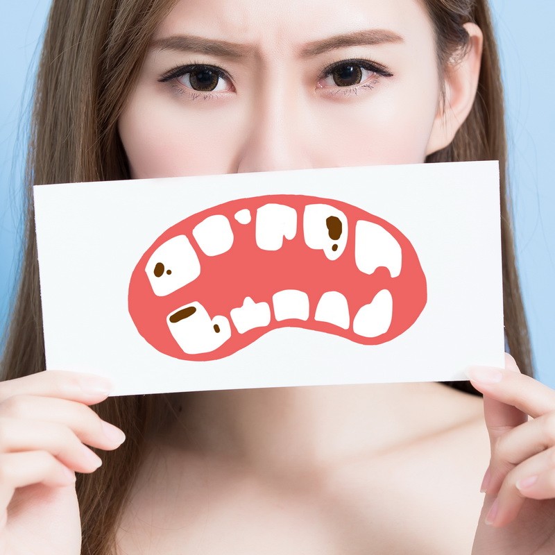 gio-endodontics--perawatan-saluran-akar-gigi