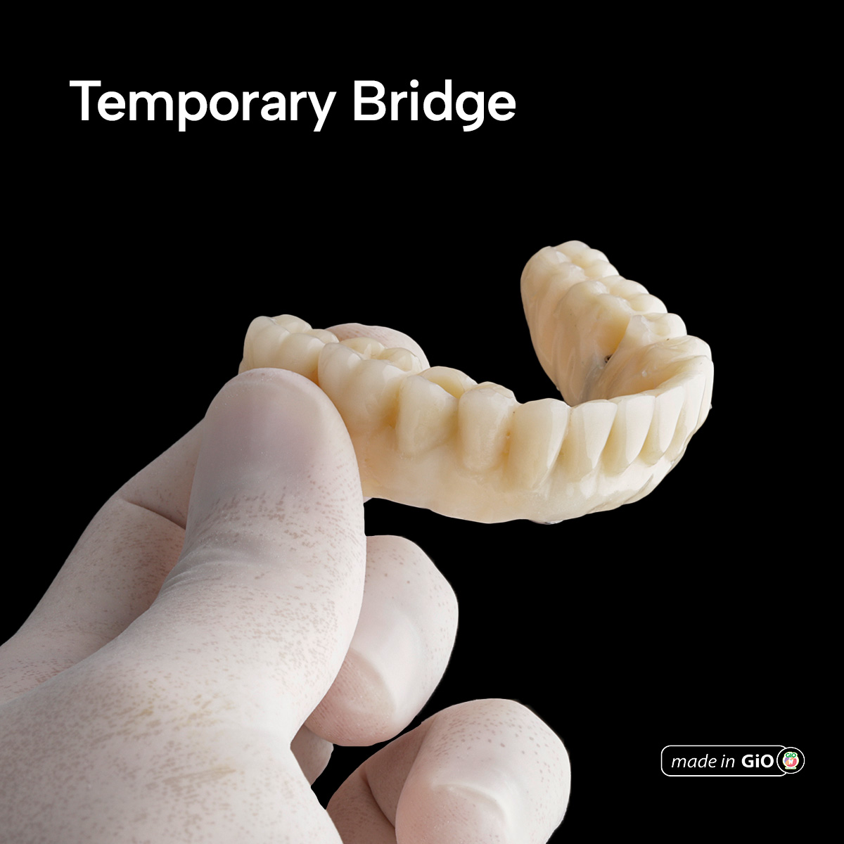gio-ceramic-crown-bridge-and-implant