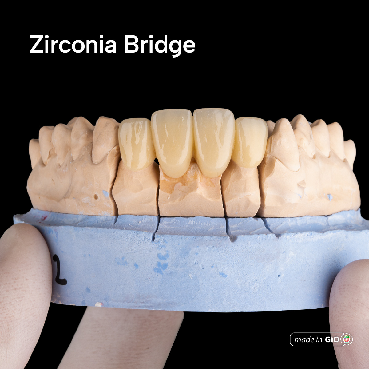 gio-ceramic-crown-bridge-and-implant