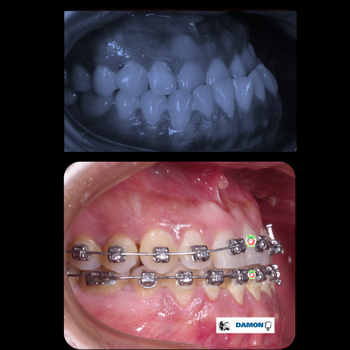 gio-orthodontic