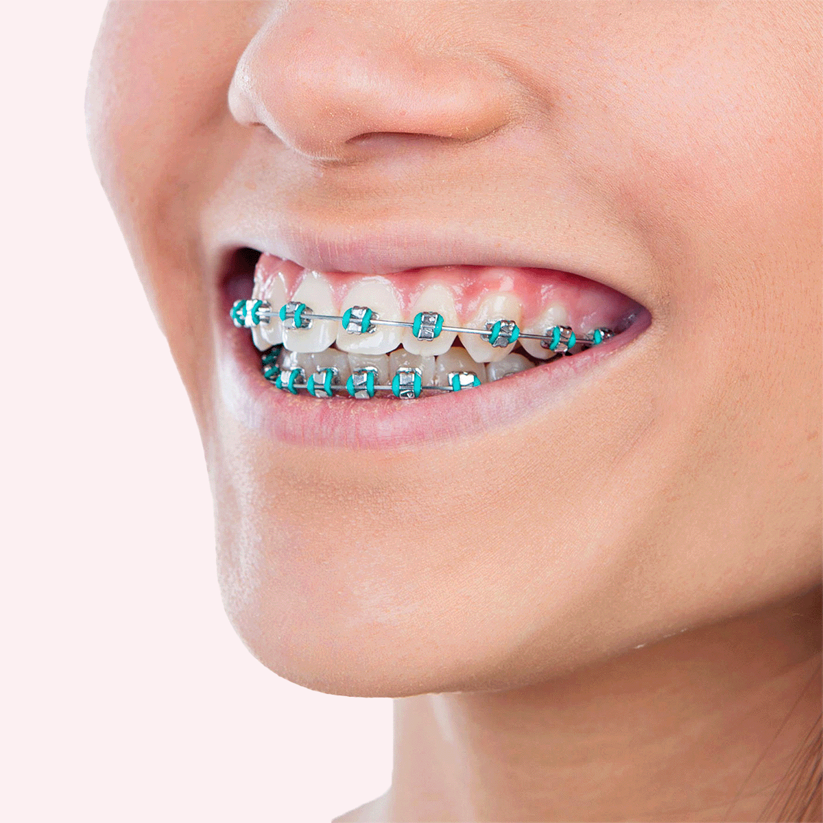 gio-orthodontic