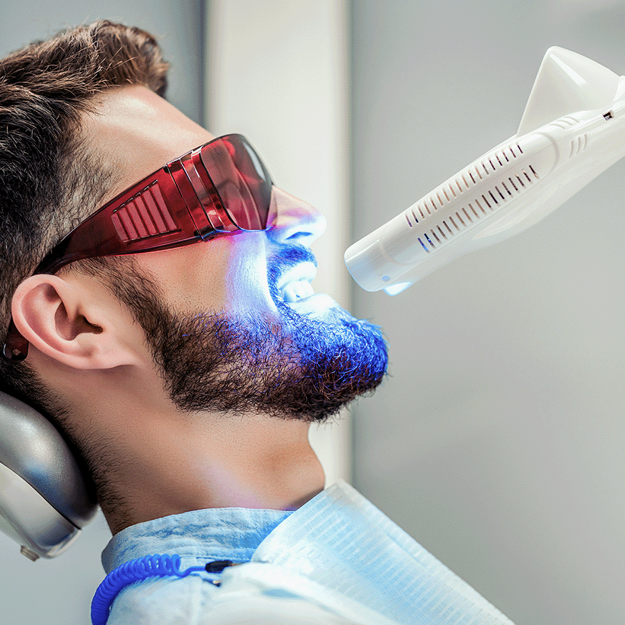 gio-deep-laser-bleaching-2